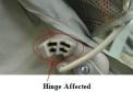 Location of affected hinge on recalled stroller